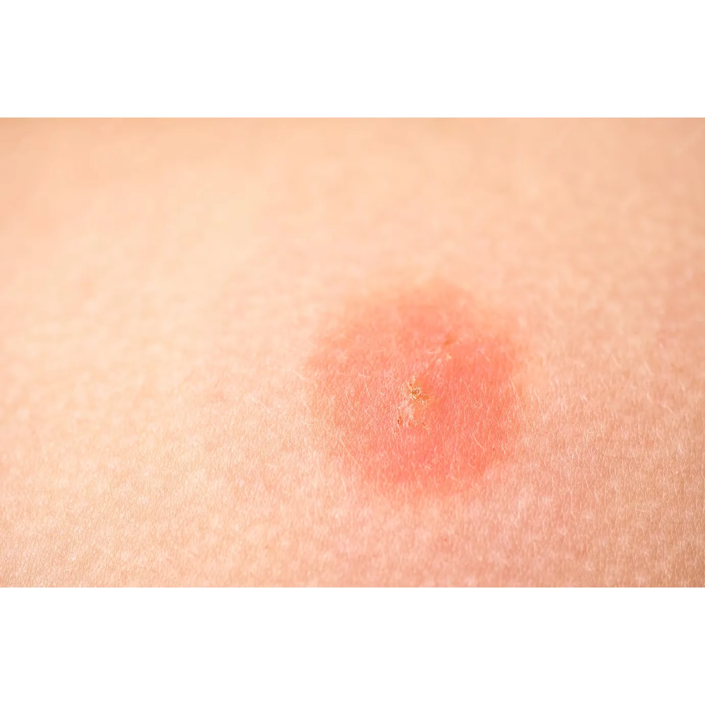 Evidence of activity attributed to Buzzington